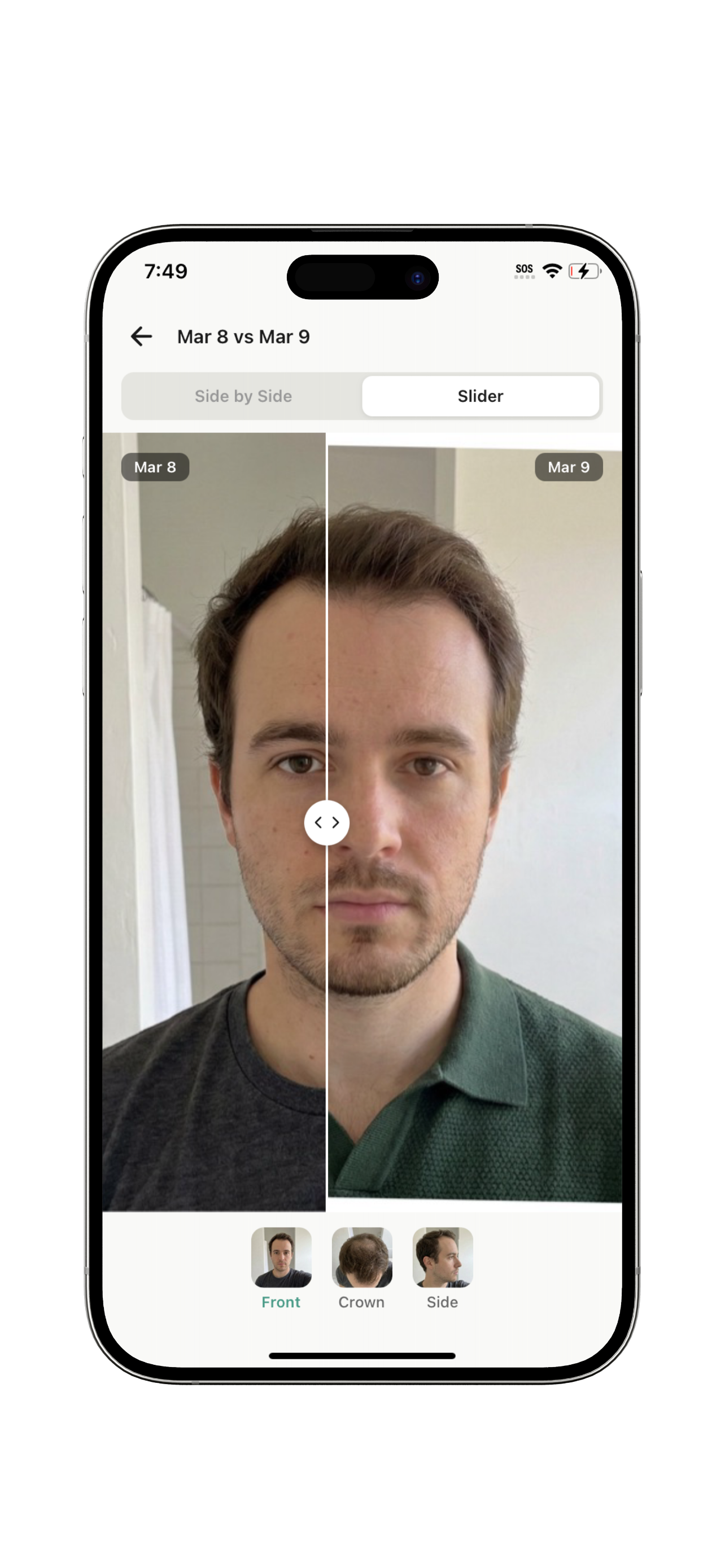 Before and after photo comparison with slider